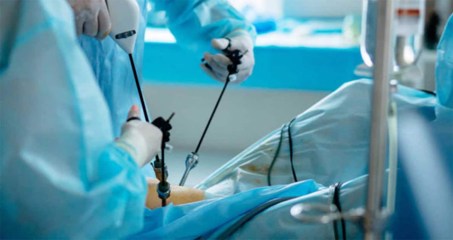 معلومات عن عملية المرارة بالمنظار هل عملية المرارة صعبة أم سهلة؟