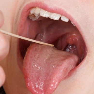 أفضل مضاد حيوي لالتهاب الحلق البكتيري