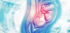 اشياء تساعد على فتح الرحم