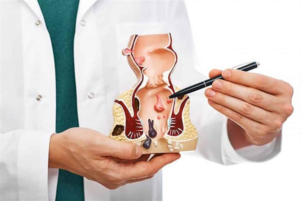 الفرق بين الناسور والبواسير