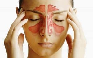 تجاربكم مع علاج الجيوب الانفيه