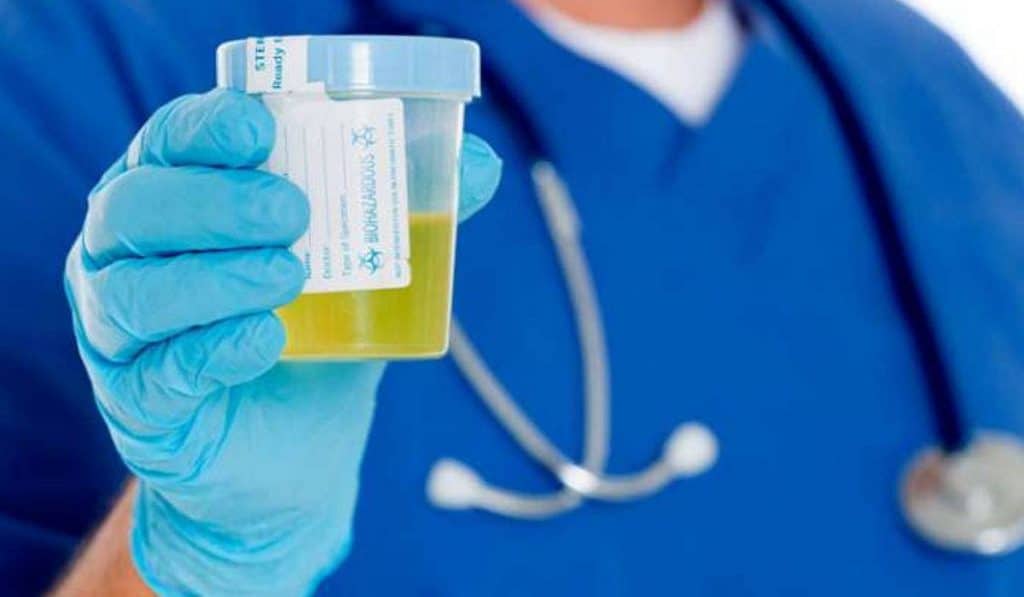 تجاربكم مع لون البول وجنس الجنين