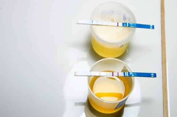 تجاربكم مع لون البول وجنس الجنين