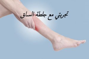 تجربتي مع جلطة الساق