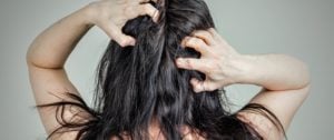 طرق علاج قشرة الشعر الدهني