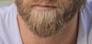 علاج شيب الذقن نهائيا