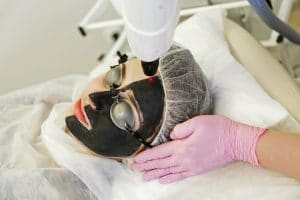 متى تظهر نتائج الليزر الكربوني