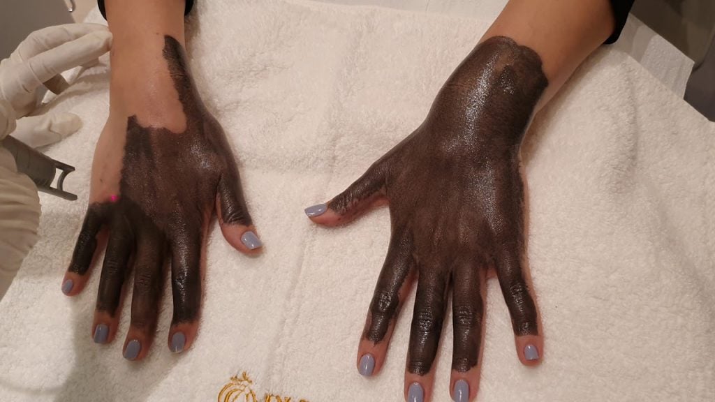 متى تظهر نتائج الليزر الكربوني