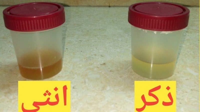 مين جربت طريقة الكلور لمعرفة الحمل