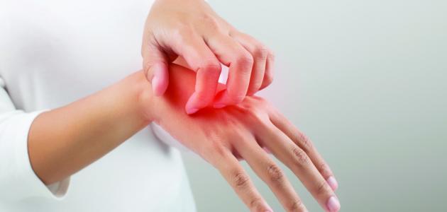 دعاء لشفاء الحساسية