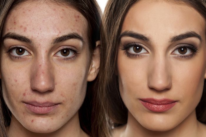 دعاء لشفاء الوجه من الحبوب