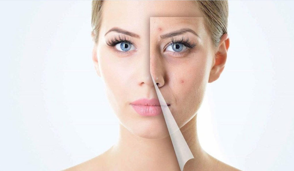 دعاء لشفاء الوجه من الحبوب